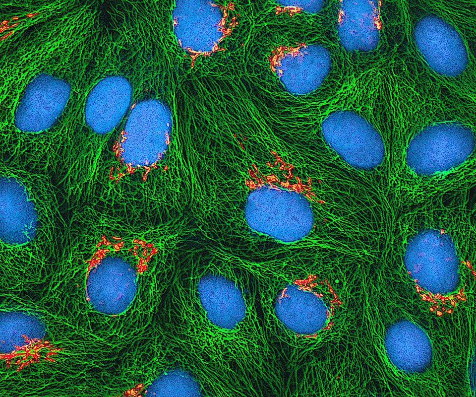 False-color microscopic image of HeLa cells, with blue nuclei and green filament-like structures.
